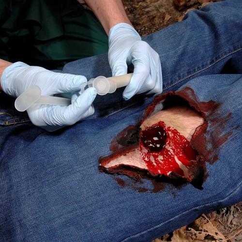 Аппликатор гемостатический с гранулами Rhino Rescue в Керчи хитозановый